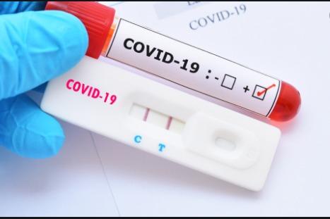 Síndromes Gripais passam a ser testadas para COVID-19