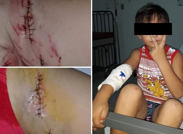 Criança é atacada por cão no Distrito de Arabá em Ouroeste
