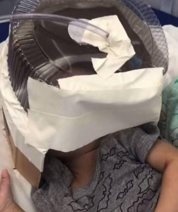 Médica improvisa embalagem de bolo como máscara de oxigênio para salvar bebê no RN