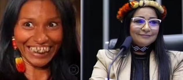 Silvia Waiãpi: quem é a deputada que teve mandato cassado por usar dinheiro de campanha para harmonização facial