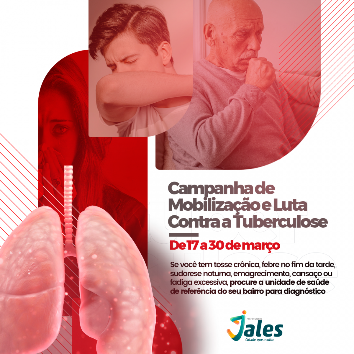 Prefeitura de Jales iniciará Campanha de Mobilização e Luta contra a Tuberculose