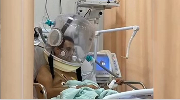 Jalesense de 40 anos se recupera da Covid usando capacete Elmo