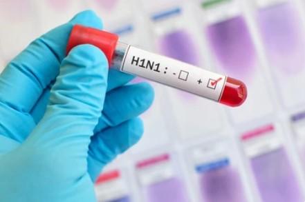 Suspeita de Primeira Morte por Gripe H1N1 em 2024 em Jales