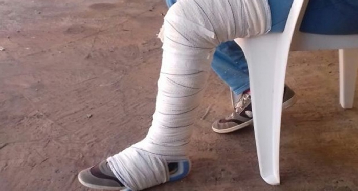 Curiosidades - Médico enfaixa perna de idosa por cima da calça e do tênis