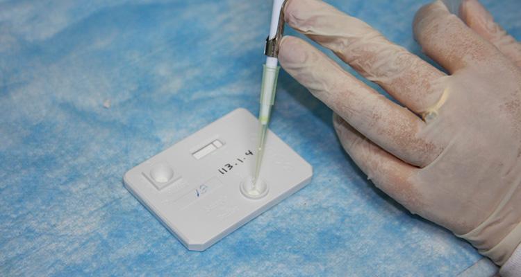 Ministério da Saúde lança projeto para teste rápido de leptospirose