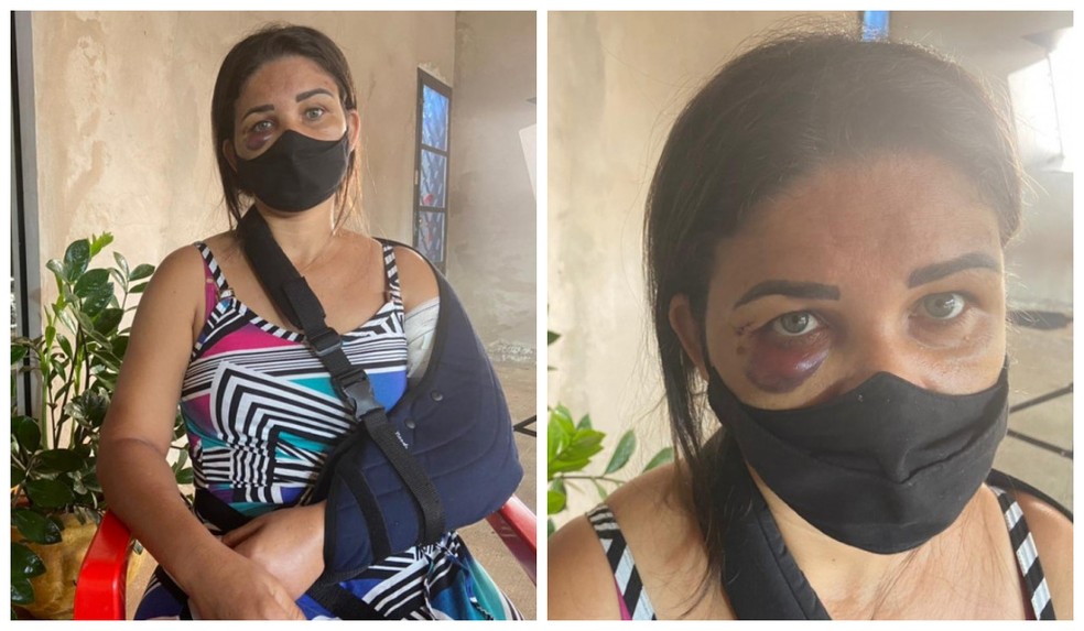 'Vi a morte', diz funcionária de padaria perseguida e agredida por pedir para cliente colocar máscara