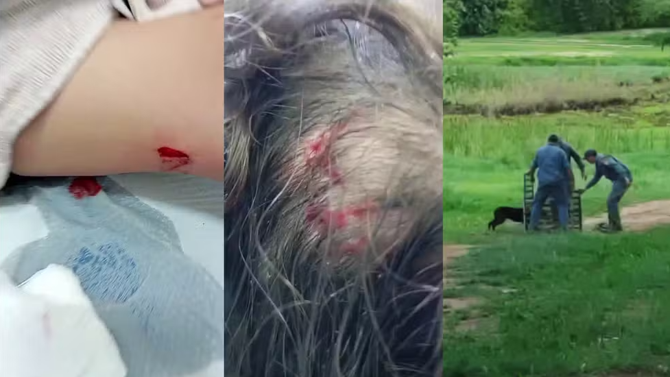 Criança de 4 anos é atacada por cão em condomínio e sofre ferimentos