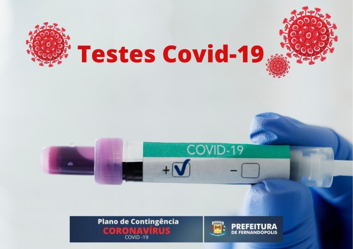 Secretaria de Saúde explica a diferença entre os testes para COVID-19
